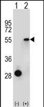 ESRRA Antibody (Center)