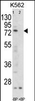 FLCN Antibody (C-term)