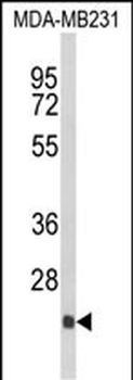 DERL2 Antibody (C-term)