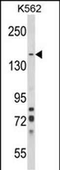 SORCS1 Antibody (N-term)