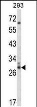 CDC42EP3 Antibody (N-term)