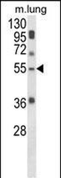 SELENBP1 Antibody (C-term)