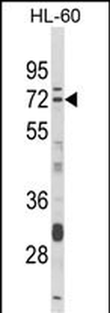 DTX4 Antibody (N-term)