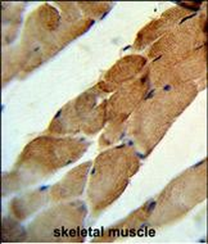 TNFSF11 Antibody (N-term)