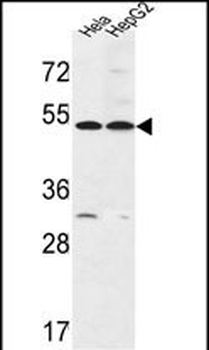 FERMT1 Antibody (Center)