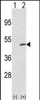 TRIB2 Antibody (N-term)