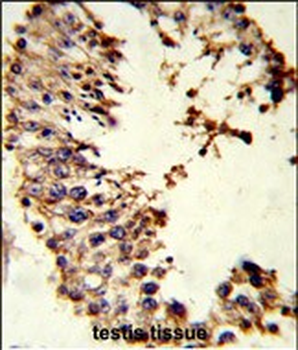 ACR Antibody (Center)