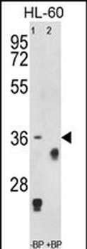 TNFRSF14 Antibody (Center)