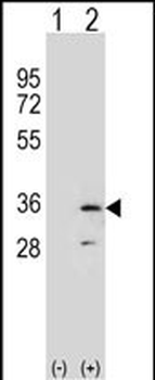 RPA2 Antibody (N-term) )