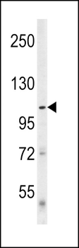 Denatured ATG1 Antibody