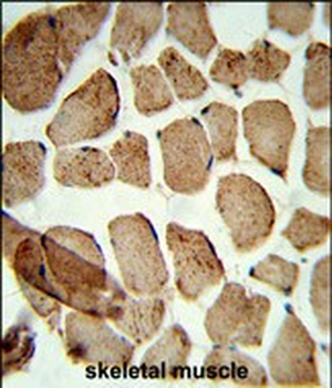 Denatured ATG1 Antibody
