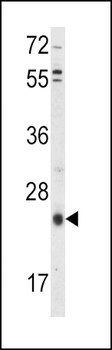 TIMP3 Antibody (Center)