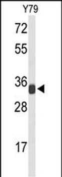 RPL5 Antibody (N-term)