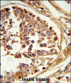 LIPE Antibody (C-term)