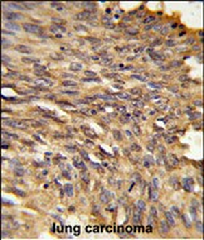 HDLBP Antibody (Center)