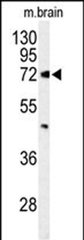 ABCD2 Antibody (Center)