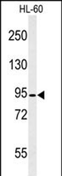 CAPN3 Antibody (C-term)