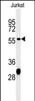 HADHB Antibody (C-term)