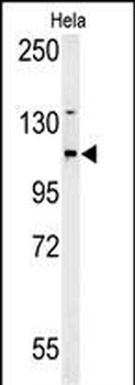 ADCY4 Antibody (Center)