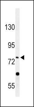 PLA2G6 Antibody (Center)