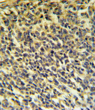 PLA2G6 Antibody (Center)