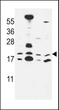 CNPY2 Antibody (C-term)