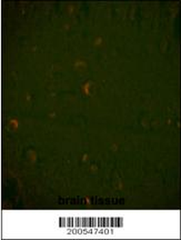 BECN1 Antibody (Ascites)