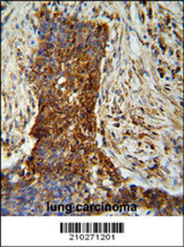 MMP2 Antibody (Ascites)