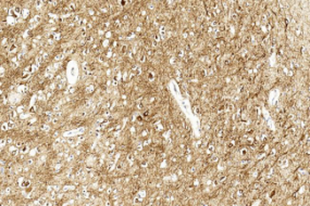 MAP2 Antibody (Ascites)