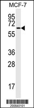MAP2 Antibody (Ascites)