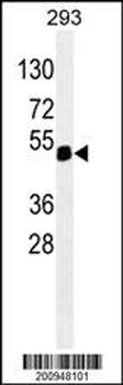 PAX6 Antibody (Ascites)