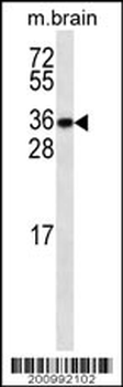 GBL Antibody (ascites)