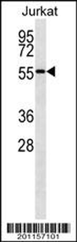 NUP50 Antibody (ascites)