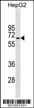 STK39 Antibody(Ascites)