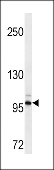 DDR2 Antibody(Ascites)