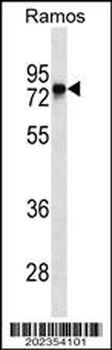 BTK Antibody (Ascites)