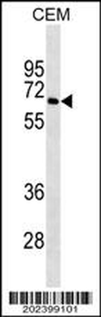BLNK Antibody (Ascites)