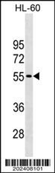 CDKN1C Antibody (Ascites)