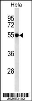 FGG Antibody (Ascites)