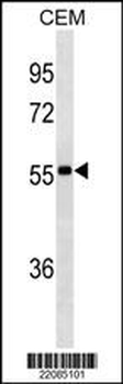 lgA Antibody (Center) (Ascites)