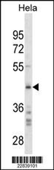 SPARC Antibody(C-term) Antibody(Ascites)