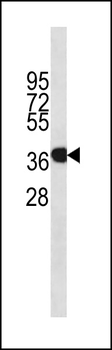 ANXA1 Antibody (Ascites)