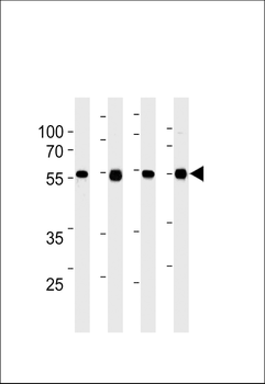TPIPb Antibody (C-term)(Ascites)