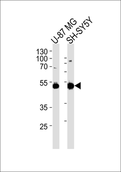 NSE Antibody
