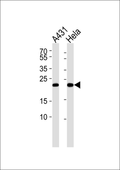 TCTP Antibody