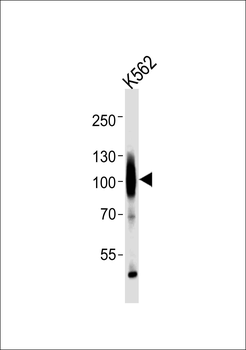 GABA-B Receptor Antibody