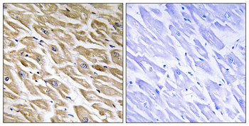MRPL39 Antibody