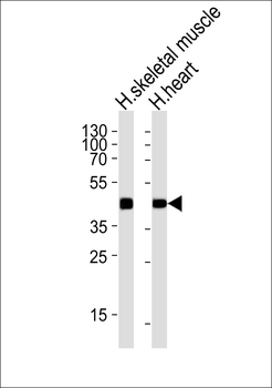 NECAB3 Antibody