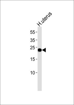 CLDN6 Antibody