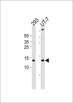 MtSSB Antibody
